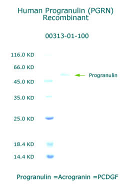 human Acrogranin recombinant