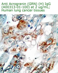 anti progranin (Human) IgG