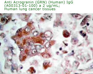 anti human acrogranin (PGRN) antibody form immunohistochemistry