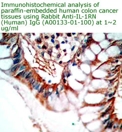 anti human sIL-1rn ANTIBODY