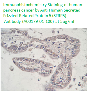 anti human sfrp-5 antibody was tested on IHC from aviscera bioscience